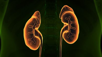 Cálculo renal na criança tem tratamento