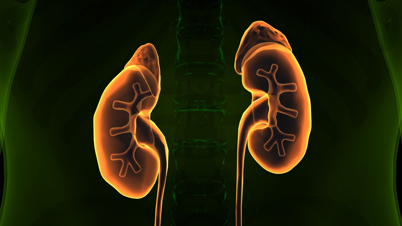 Cálculo renal na criança tem tratamento