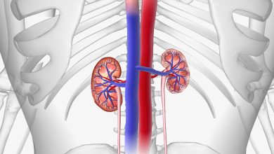 Ureterocele na infância como tratar